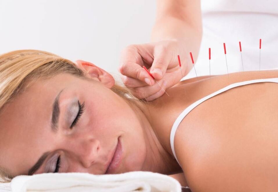 Acupunctura va ajuta la ameliorarea durerii în osteocondroză